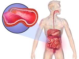 graphic depicting the lower bowel